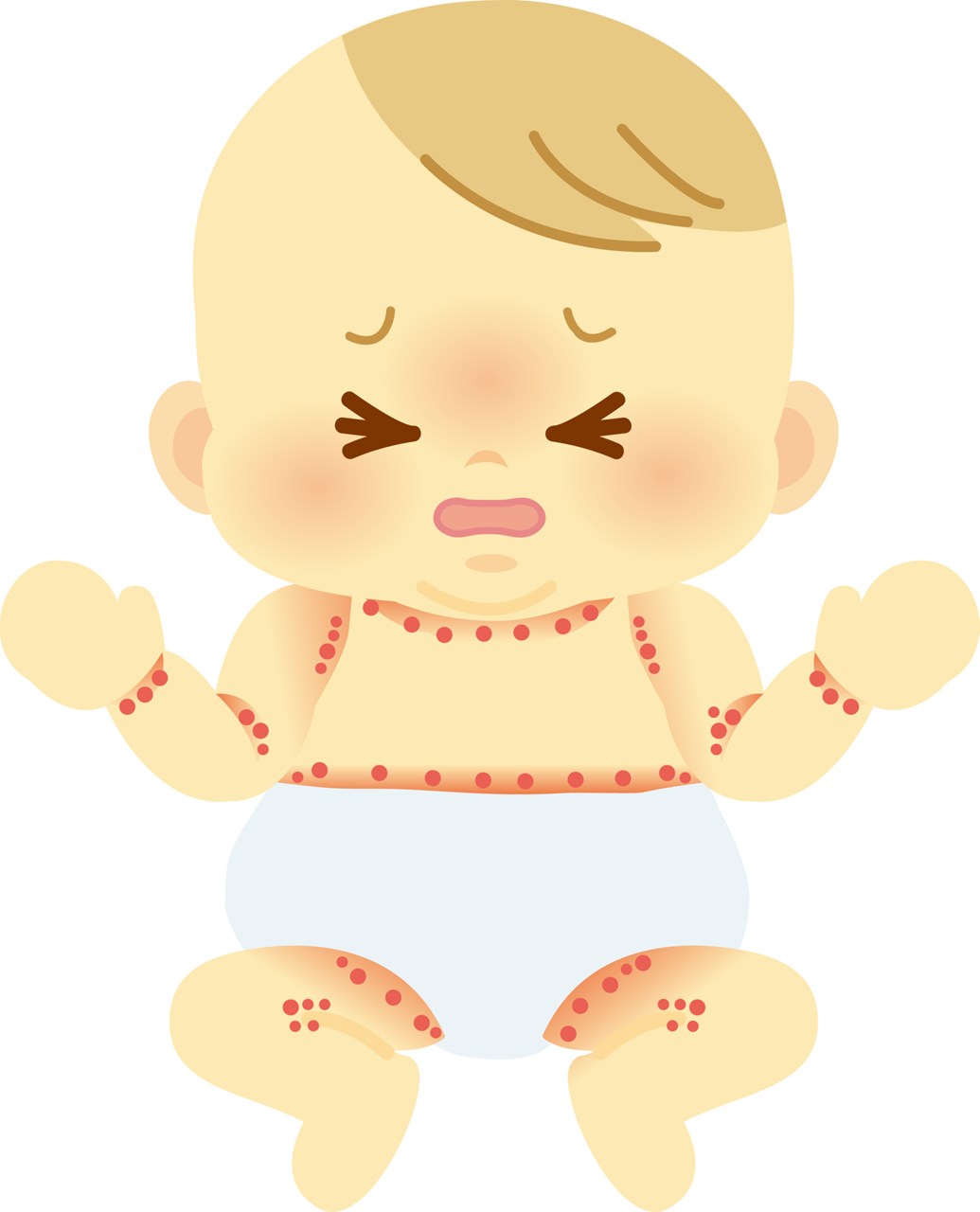 汗疹（あせも）