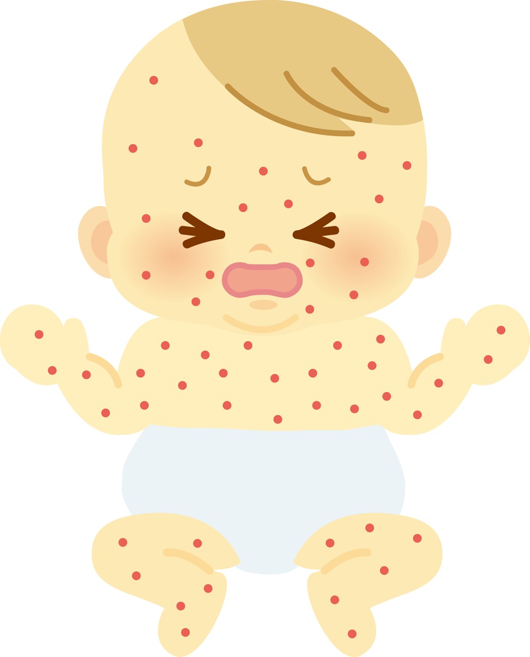 じんましん