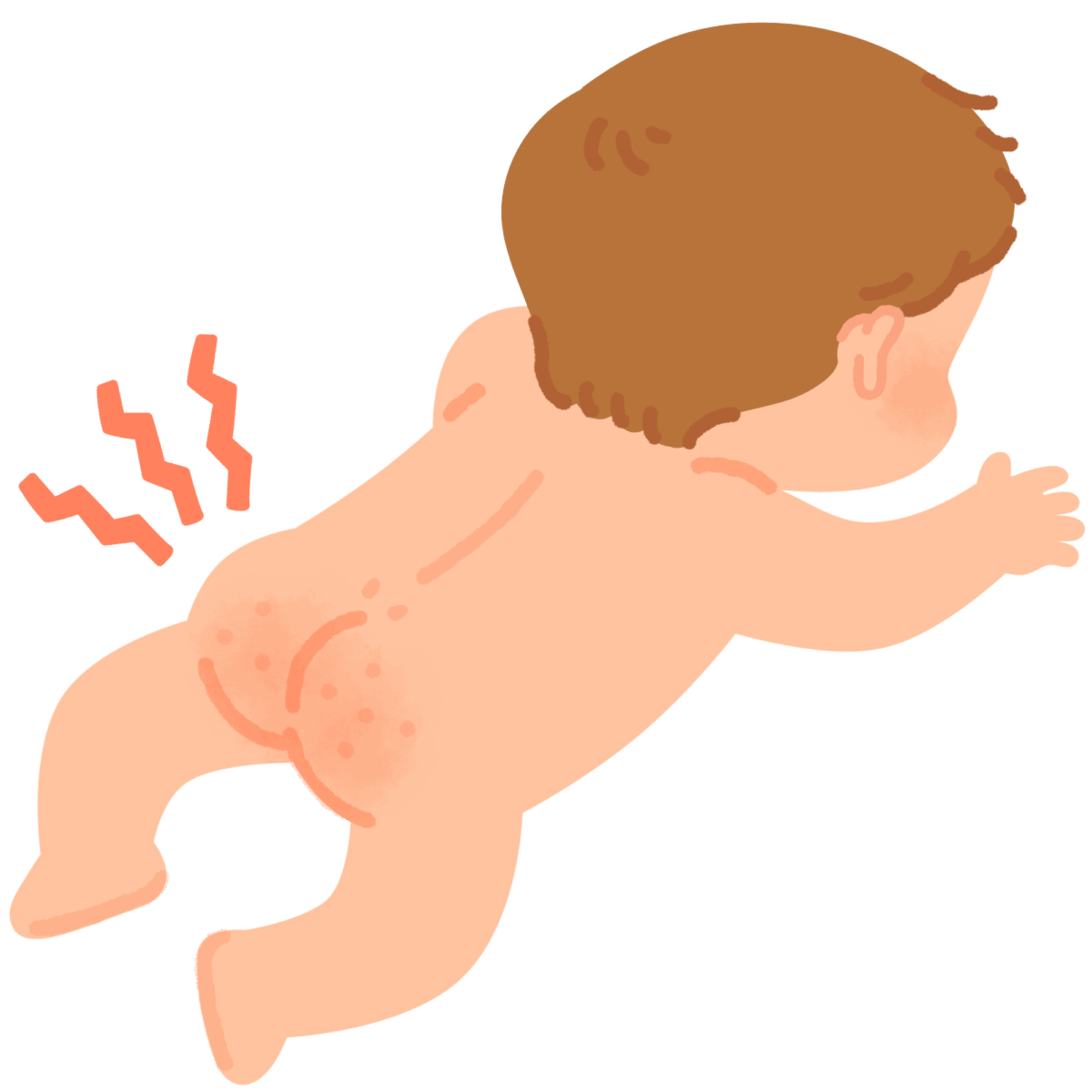こどもの肛門周囲膿瘍の原因